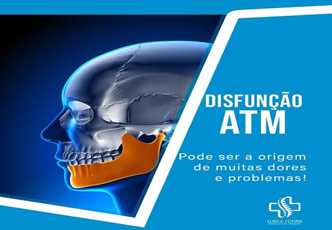 QUIROPRAXIA EM GOVERNADOR VALADARES MG (33) 99122-8570 QUIROPRAXIA EM GOVERNADOR VALADARES MG (33) 99122-8570
